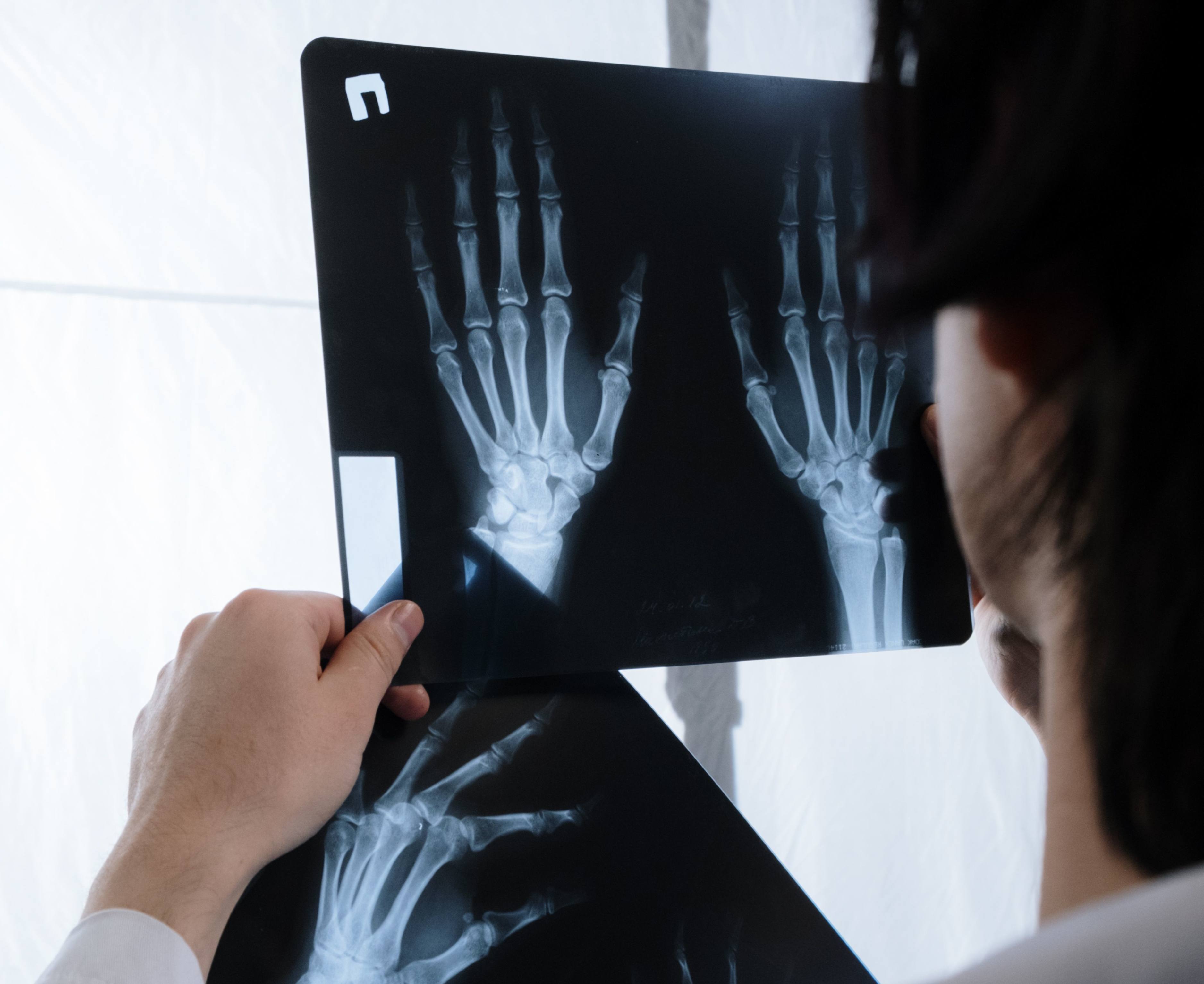 Why Can X-rays See Your Bones but Not Through Everything? — article hero image